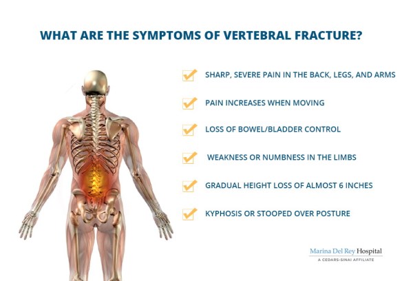 vertebral-fracture-symptoms